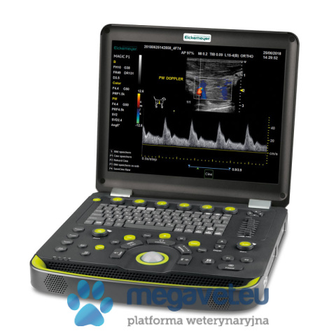 Portable ultrasound camera MAGIC P1