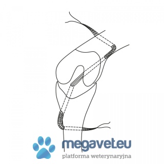 Zlig – Anterior cruciate ligament restoration technique [ECM]