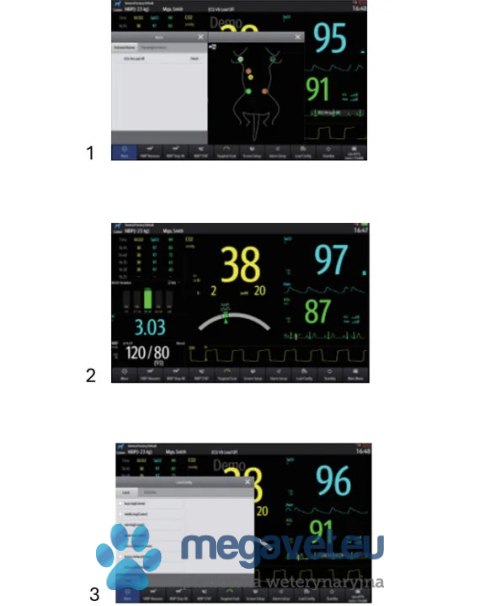 Mindray ePM 12M Vet - Kardiomonitor Dotykowy Premium (MWT)