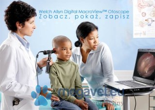 Otoskop - Videootoskop MacroView Welch Allyn (MDA)
