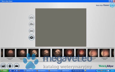Otoskop - Videootoskop MacroView Welch Allyn (MDA)