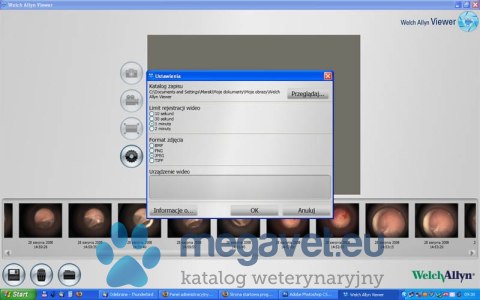 Otoskop - Videootoskop MacroView Welch Allyn (MDA)