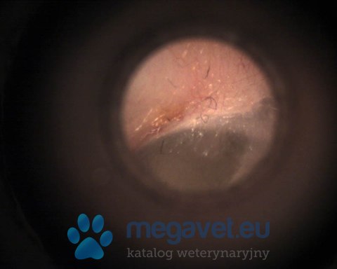 Otoskop - Videootoskop MacroView Welch Allyn (MDA)