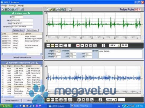 Stetoskop Elektroniczny JABES J5 SMARTPHONE AUDIOGRAM (MDA)