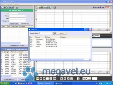 Stetoskop Elektroniczny JABES J5 SMARTPHONE AUDIOGRAM (MDA)
