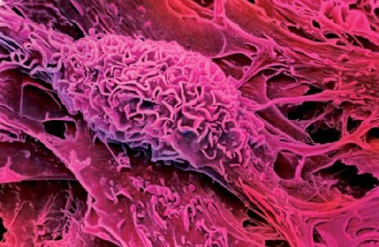 Komórki macierzyste w terapii przeciwnowotworowej
